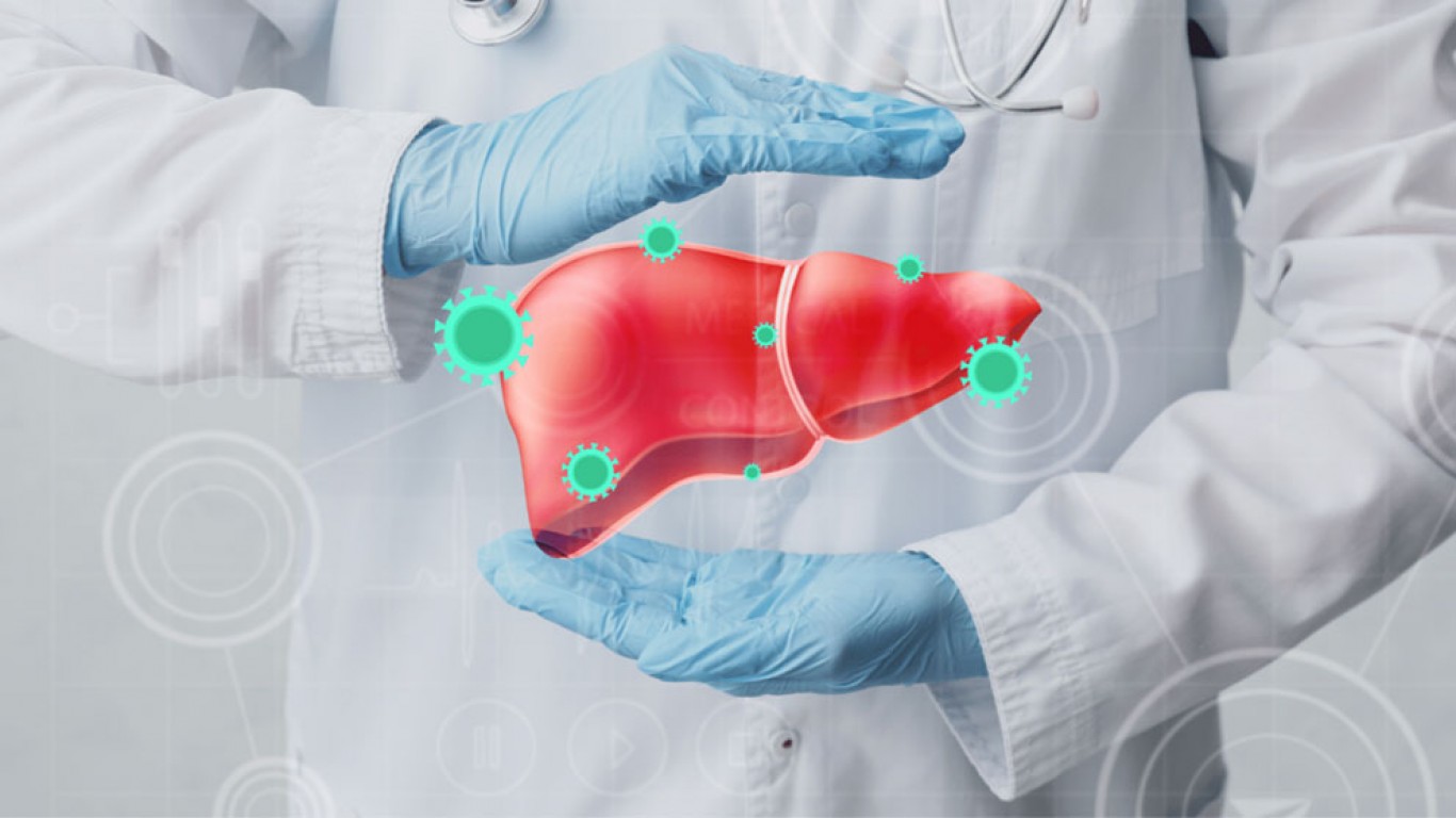 Hepatitis - Prevencija i mere lečenja Hepatitis - Prevencija i mere lečenja